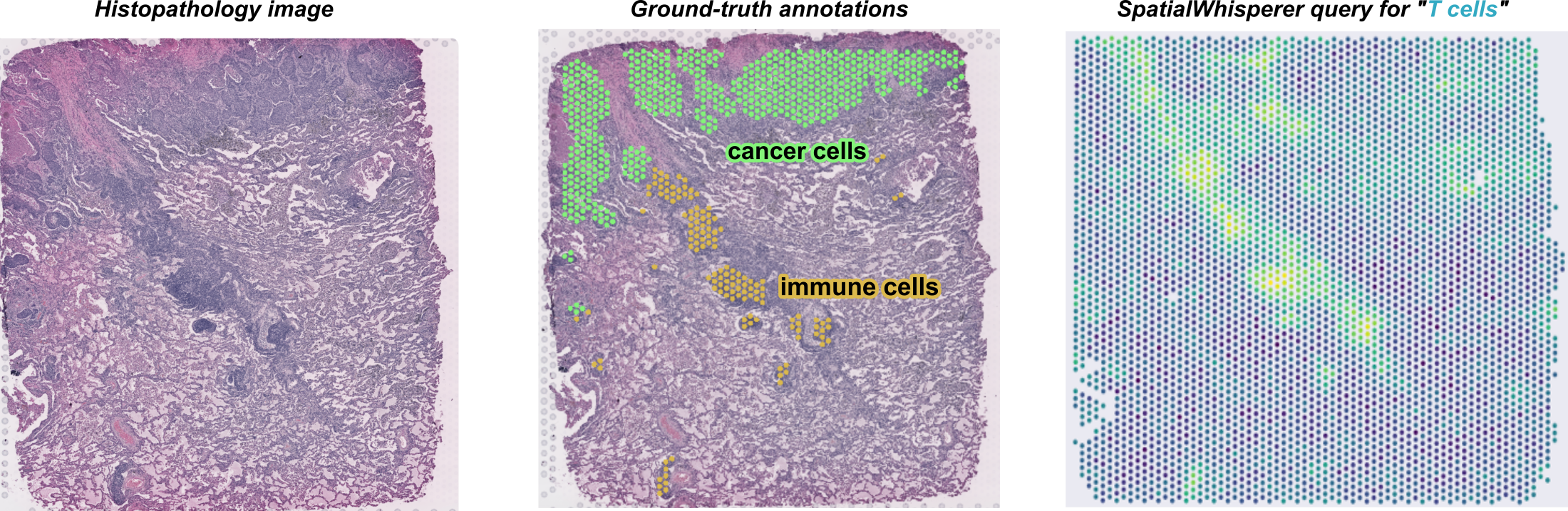 Zero-shot lung-cancer annotation